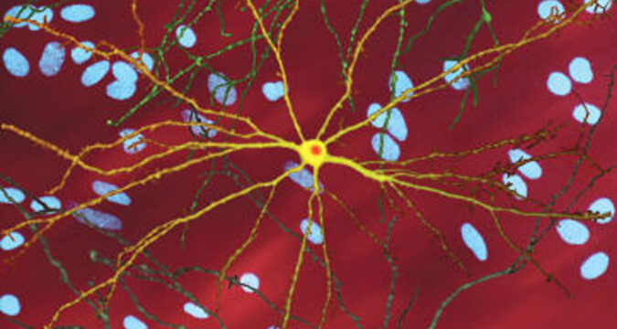 Medible review how medical marijuana can mitigate symptoms of huntingtons disease