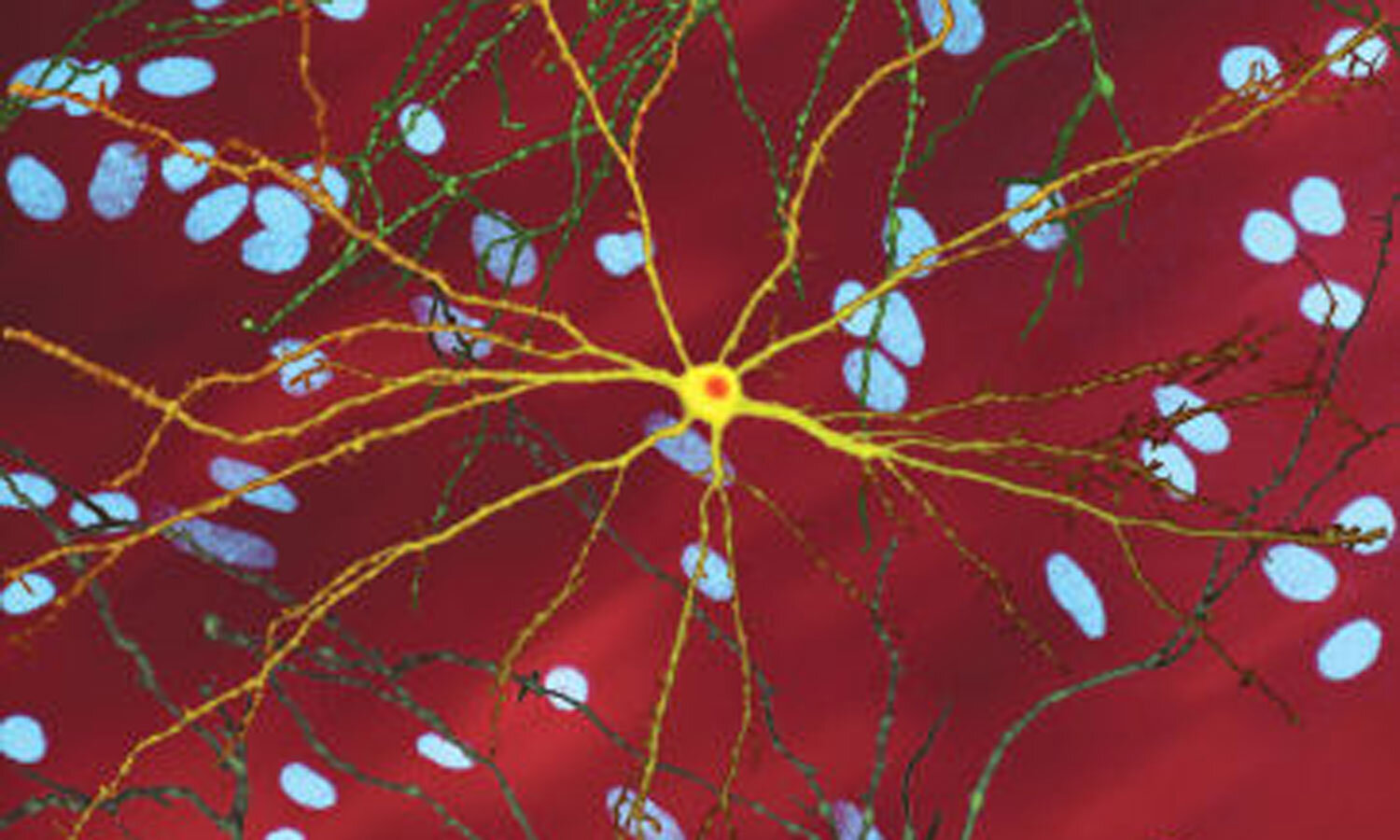 Medible review how medical marijuana can mitigate symptoms of huntingtons disease