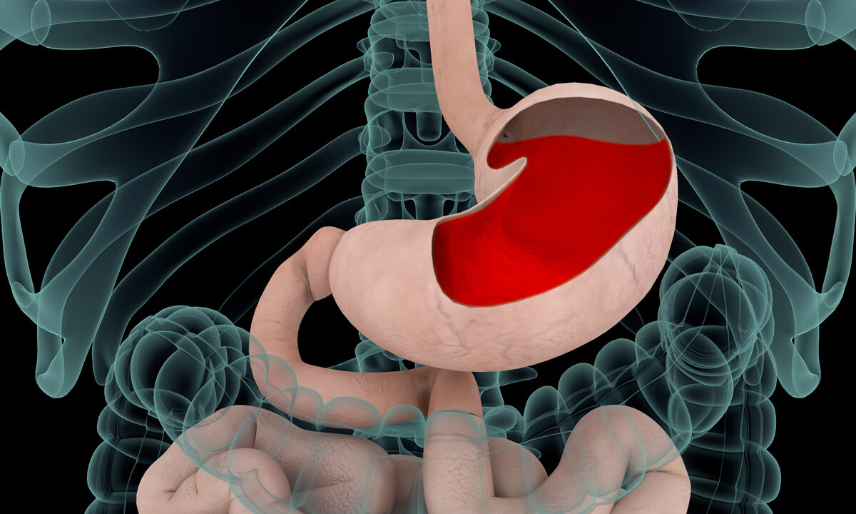 Medible review can cannabis treat gastroesophageal reflux disease gerd